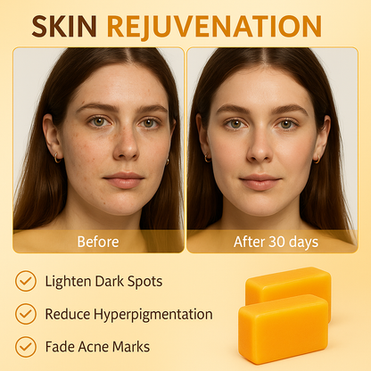 Skinova Turmeric & Kojic Acid Soap